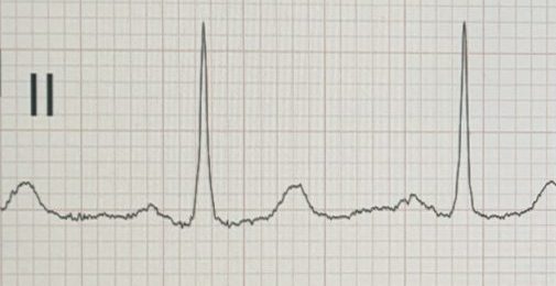 Cardiologo Perugia